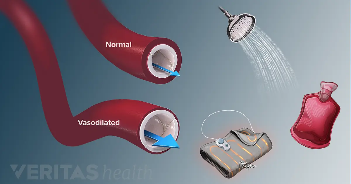 Heat impacts. Heat Therapy. Heat Therapy er. Heating things up картинки.