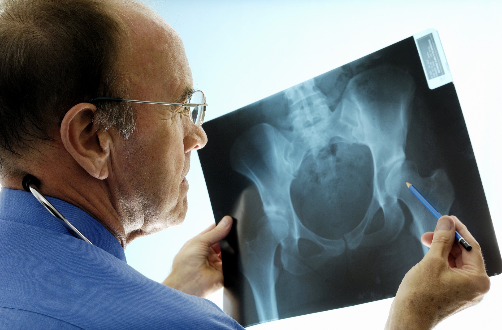 Orthopedic Surgeons: Seven Things You Need to Know